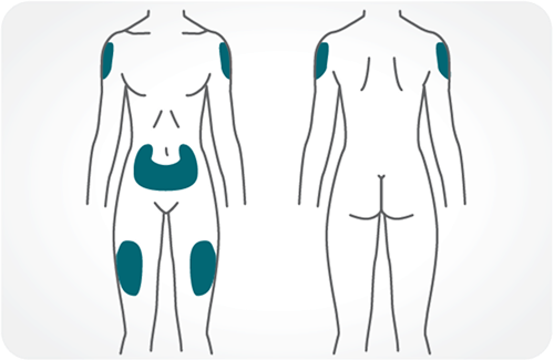Approved GLP-1 injection sites diagram